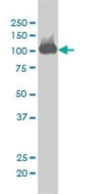 Western Blot: CSE1L/CAS/Exportin-2 Antibody (2C10) [H00001434-M03]