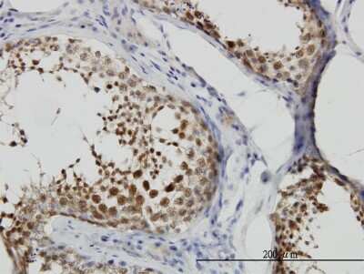 Immunohistochemistry-Paraffin: CSE1L/CAS/Exportin-2 Antibody (2F4) [H00001434-M04]