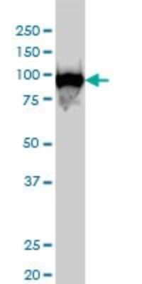 Western Blot: CSE1L/CAS/Exportin-2 Antibody (2F4) [H00001434-M04]