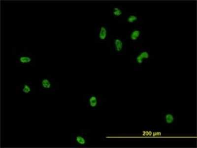 Immunocytochemistry/ Immunofluorescence: CSE1L/CAS/Exportin-2 Antibody (3D8) [H00001434-M08]