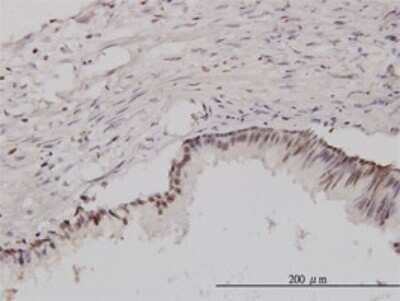 Immunohistochemistry-Paraffin: CSE1L/CAS/Exportin-2 Antibody (3D8) [H00001434-M08]