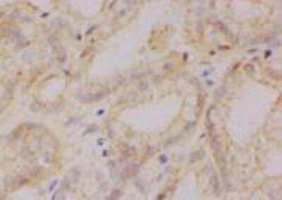 Immunohistochemistry-Paraffin: CSE1L/CAS/Exportin-2 Antibody (3D8) [H00001434-M08]
