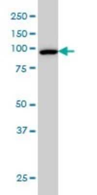 Western Blot: CSE1L/CAS/Exportin-2 Antibody (3D8) [H00001434-M08]