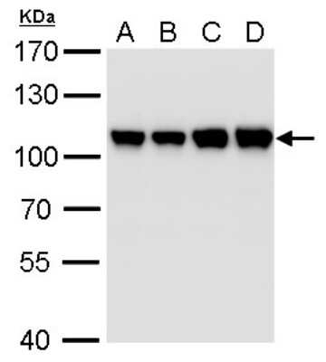 Western Blot: CSE1L/CAS/Exportin-2 Antibody (5111) [NBP2-43609]