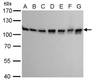 Western Blot: CSE1L/CAS/Exportin-2 Antibody (5111) [NBP2-43609]
