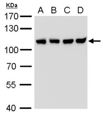 Western Blot: CSE1L/CAS/Exportin-2 Antibody (729) [NBP2-43610]