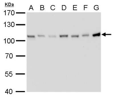 Western Blot: CSE1L/CAS/Exportin-2 Antibody (729) [NBP2-43610]