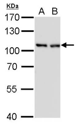 Western Blot: CSE1L/CAS/Exportin-2 Antibody (729) [NBP2-43610]