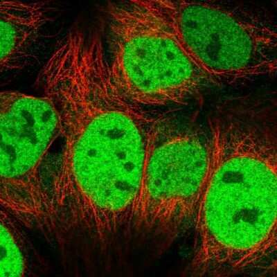 Immunocytochemistry/ Immunofluorescence: CSE1L/CAS/Exportin-2 Antibody [NBP2-38384]