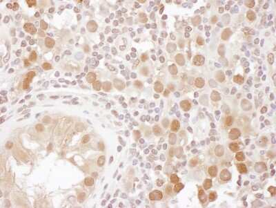 Immunohistochemistry-Paraffin: CSE1L/CAS/Exportin-2 Antibody [NB100-79803]