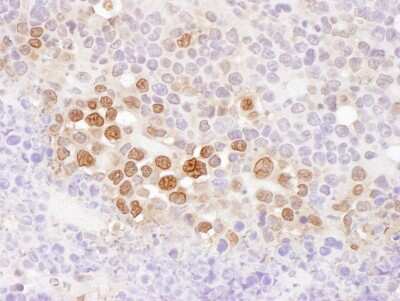 Immunohistochemistry-Paraffin: CSE1L/CAS/Exportin-2 Antibody [NB100-79803]