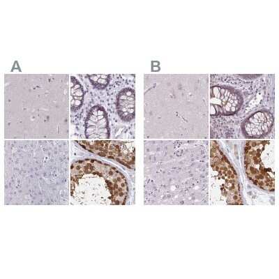 Immunohistochemistry-Paraffin: CSE1L/CAS/Exportin-2 Antibody [NBP2-38383]