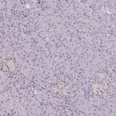 Immunohistochemistry-Paraffin: CSE1L/CAS/Exportin-2 Antibody [NBP2-38384]