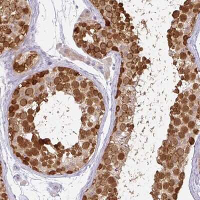 Immunohistochemistry-Paraffin: CSE1L/CAS/Exportin-2 Antibody [NBP2-38384]