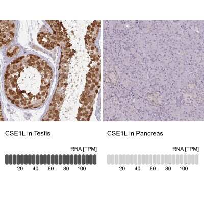 Immunohistochemistry-Paraffin: CSE1L/CAS/Exportin-2 Antibody [NBP2-38384]