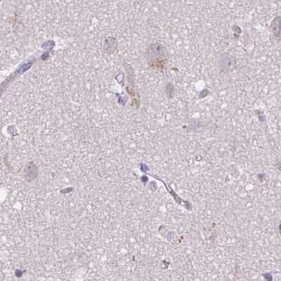 Immunohistochemistry-Paraffin: CSE1L/CAS/Exportin-2 Antibody [NBP2-38384]