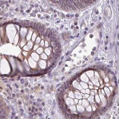 Immunohistochemistry-Paraffin: CSE1L/CAS/Exportin-2 Antibody [NBP2-38384]