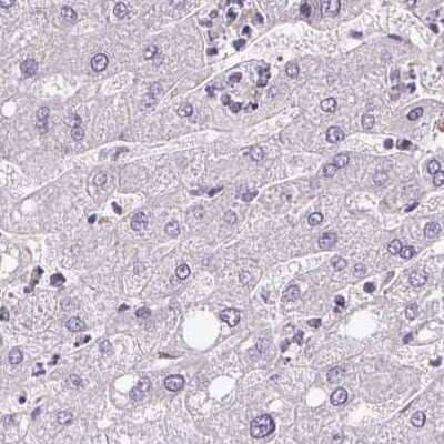 Immunohistochemistry-Paraffin: CSE1L/CAS/Exportin-2 Antibody [NBP2-38384]
