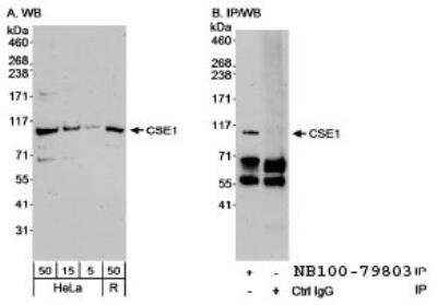 Immunoprecipitation: CSE1L/CAS/Exportin-2 Antibody [NB100-79803]