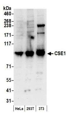 Western Blot: CSE1L/CAS/Exportin-2 Antibody [NB100-79803]