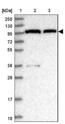 Western Blot: CSE1L/CAS/Exportin-2 Antibody [NBP2-38383]