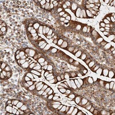 Immunohistochemistry-Paraffin: CSGALNACT2 Antibody [NBP1-81851]