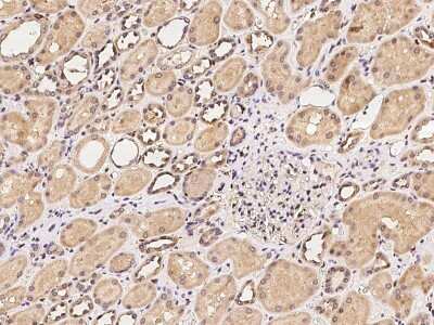 Immunohistochemistry-Paraffin: CSGALNACT2 Antibody [NBP2-97361]