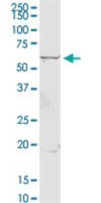 Western Blot: CSGALNACT2 Antibody [H00055454-D01P]