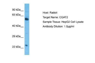 Western Blot: CSGALNACT2 Antibody [NBP2-84727]