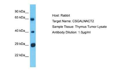 Western Blot: CSGALNACT2 Antibody [NBP2-84728]