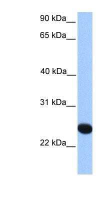 Western Blot: CSGLCAT Antibody [NBP1-55085]