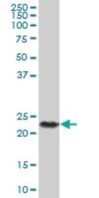 Western Blot: CSH2 Antibody [H00001443-B01P]