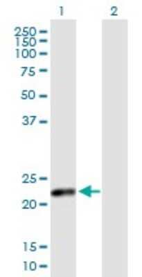 Western Blot: CSH2 Antibody [H00001443-B02P]