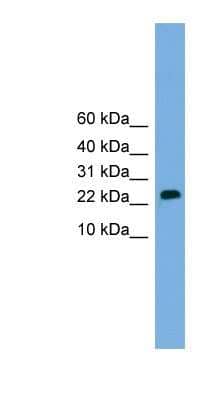 Western Blot: CSH2 Antibody [NBP1-57026]