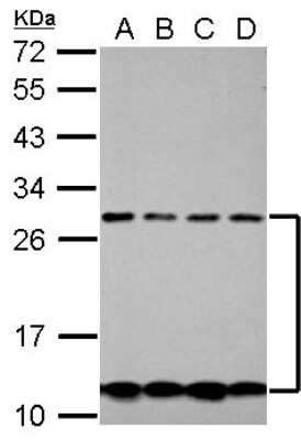 Western Blot: CSH2 Antibody [NBP2-16019]