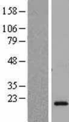 Western Blot: CSH2 Overexpression Lysate [NBL1-09523]