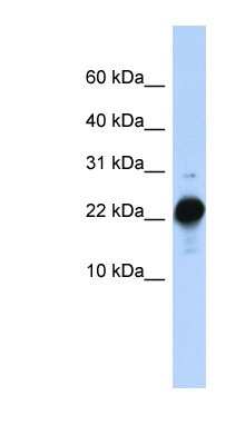 Western Blot: CSHL1 Antibody [NBP1-59312]