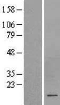 Western Blot: CSHL1 Overexpression Lysate [NBL1-09524]