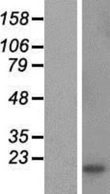 Western Blot: CSHL1 Overexpression Lysate [NBP2-09902]