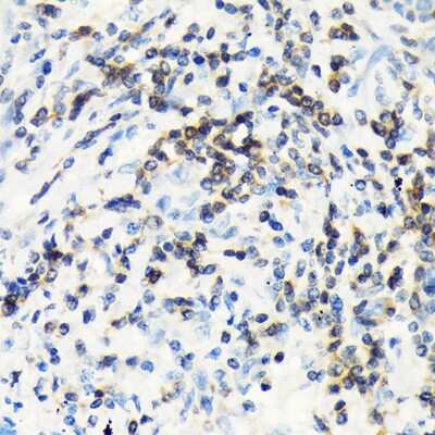 Immunohistochemistry-Paraffin: CSK Antibody (1A2F5) [NBP3-15297]