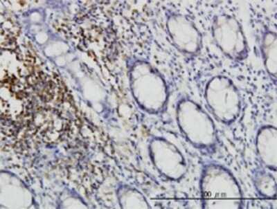 Immunohistochemistry-Paraffin: CSK Antibody (3A3) [H00001445-M01]