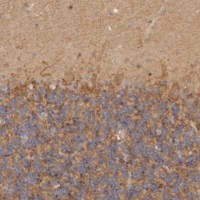 Immunohistochemistry-Paraffin: CSK Antibody [NBP1-85951]