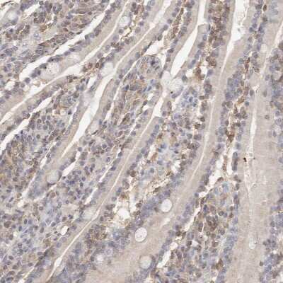 Immunohistochemistry-Paraffin: CSK Antibody [NBP1-85951]