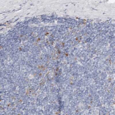 Immunohistochemistry-Paraffin: CSK Antibody [NBP1-89521]