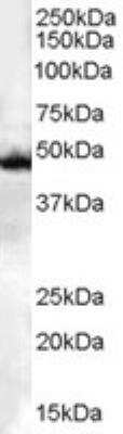 Western Blot: CSK Antibody [NB100-808]