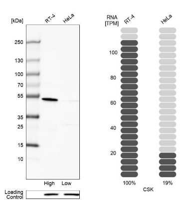 Western Blot: CSK Antibody [NBP1-85951]
