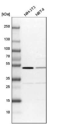 Western Blot: CSK Antibody [NBP1-85951]