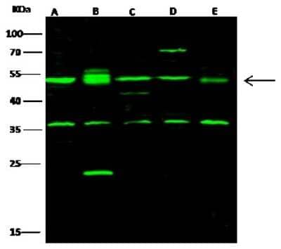 Western Blot: CSK Antibody [NBP2-98358]