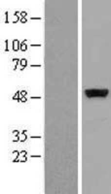 Western Blot: CSK Overexpression Lysate [NBL1-09525]