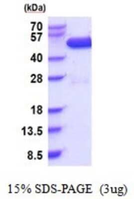 SDS-PAGE: Recombinant Human CSK His Protein [NBP2-51853]